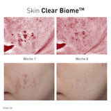 Advanced Nutrition Programme - Skin Clear Biome - Nahrungsergänzung - Advanced Nutrition Programme - ZEITWUNDER Onlineshop - Kosmetik online kaufen